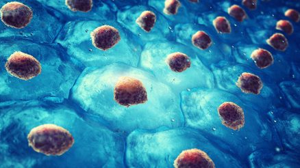 Stem Cell Therapy