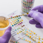 Does CBD Oil Show Up in Drug Test?
