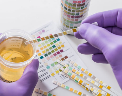 Do Drug Test Show The Difference Between CBD and THC? Does CBD Oil Show Up in Drug Test?